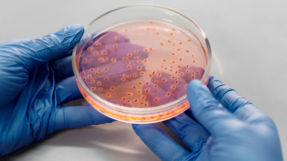 Eliminare la contaminazione microbiologica in camera bianca